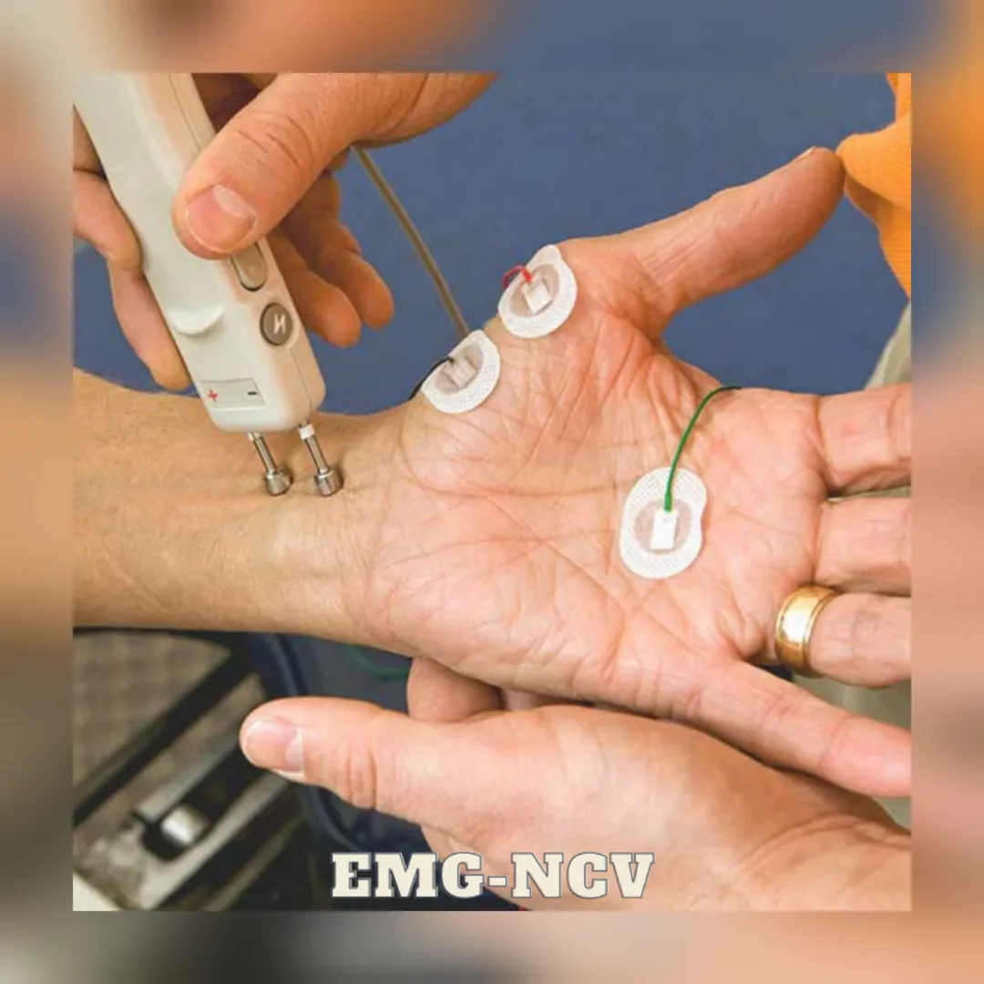 EMG-NCV image 2